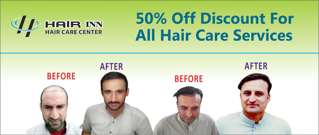 Welcome - Hair INN Hair Transplant in Peshawar, Hair Transplant Peshawar